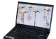 深度评析ThinkPadT510i笔记本电脑的性能与功能（ThinkPadT510i在商务应用和日常办公中的卓越表现）