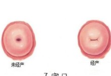 须产恢复快的视频教程（学习如何通过视频快速恢复须产）